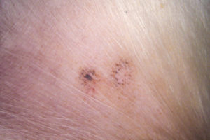 flea and tick prevention for dogs