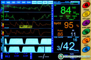 anesthesia monitoring and safety