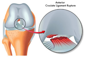 degenerative joint disease in dogs
