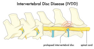 intervertebral disc disease