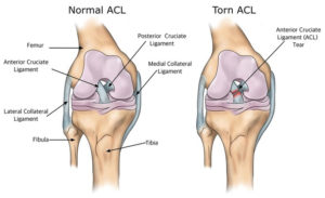 degenerative joint disease in dogs