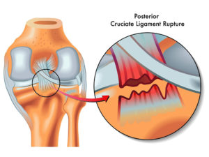 degenerative joint disease in dogs