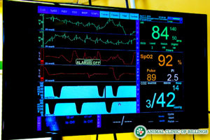 digital anesthetic monitor for surgery